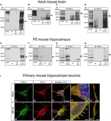 K+/Cl− cotransporter 2 (KCC2) and Na+/HCO3− cotransporter 1 (NBCe1) interaction modulates profile of KCC2 phosphorylation